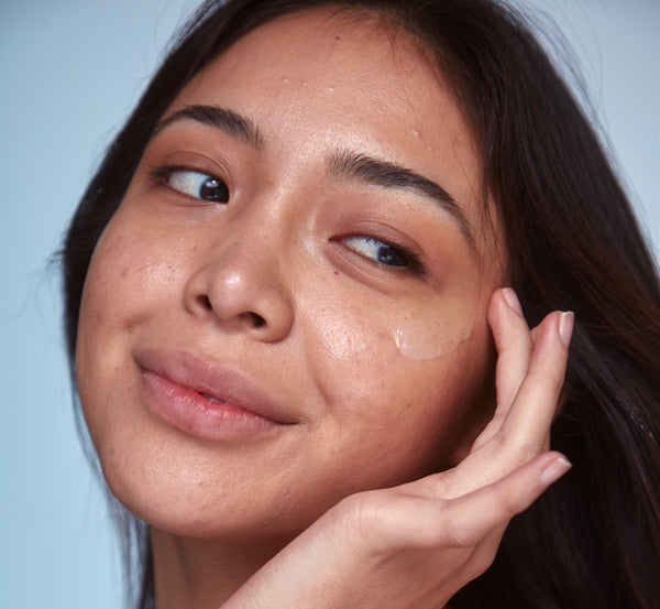 girl applying moisturizer to skin for acne prone skin