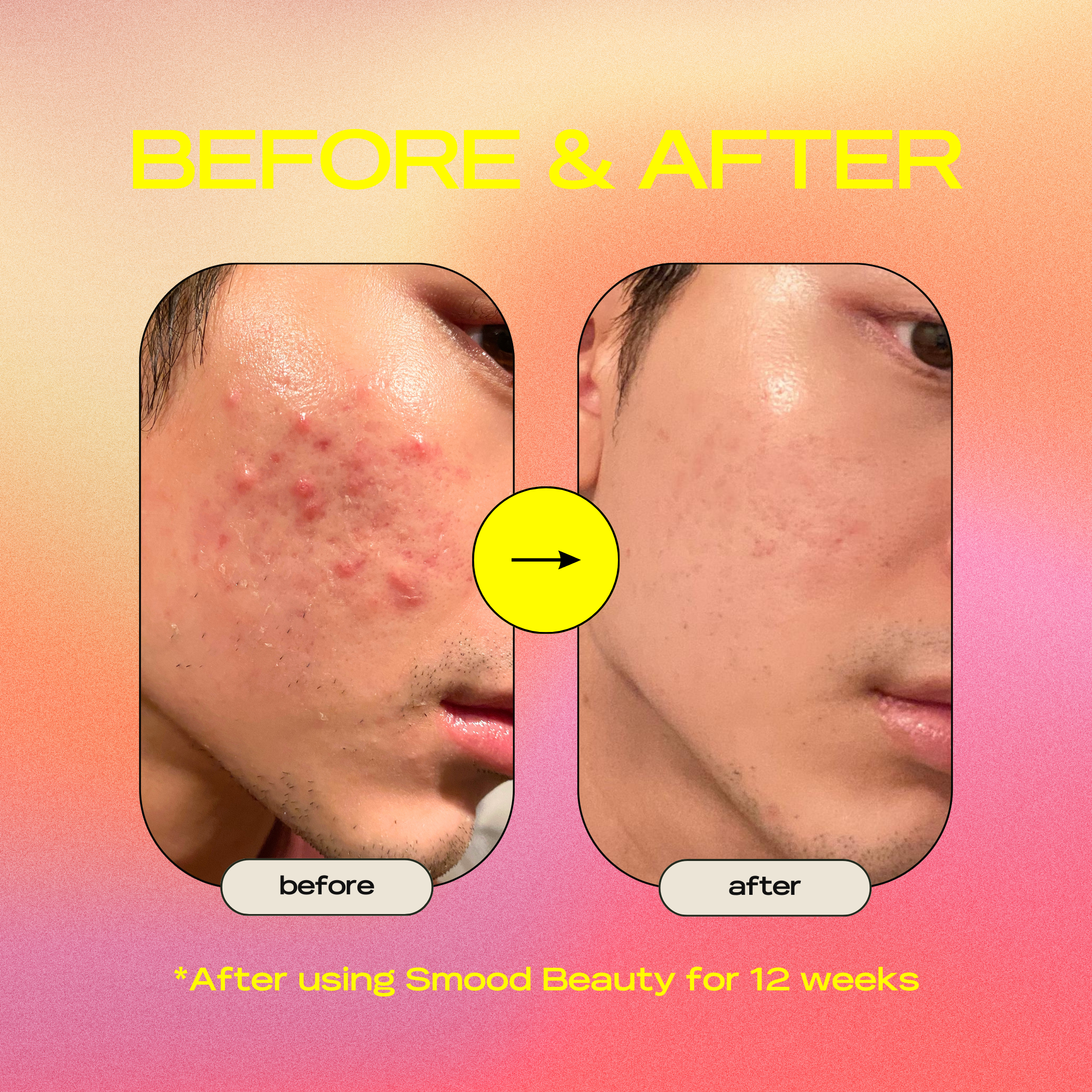 Super Cera Clarifying Barrier Serum